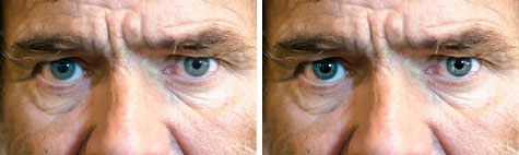 Vorher-Nachher-Beispiel für mit Scharfzeichner behandelte Augen